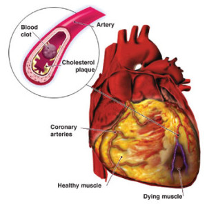 peperoncino e malattie cardiovascolari